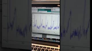 Lab 6: Heart rate from ECG in Arduino