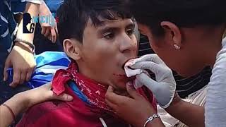 Los Sueños Truncados De Alvarito Por Las Balas Del Régimen