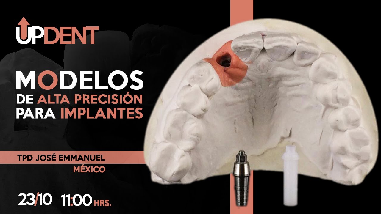 Modelos de Alta Precisión para Implantes dental bridge