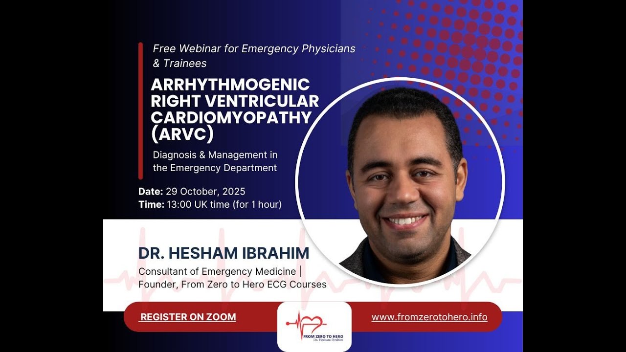 Мастерство ЭКГ: Страшный обморок — когда синкопе не является доброкачественным состоянием | ЭКГ п...