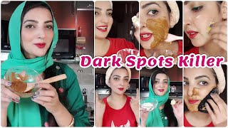 Remove Instant Brown Spots 100% Hyper-pigmentation Get Soft Skin, Fade Dark Spots at Home screenshot 4