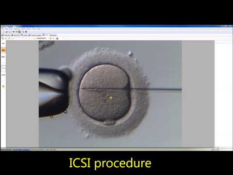 ICSI procedure