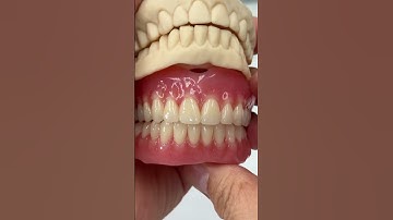 Duplicate old dentures @EnvisiontecMain #envisiontec