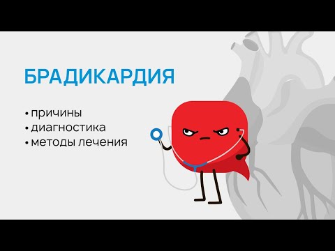 Видео: Причини и симптоми на сърдечна брадикардия