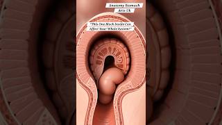 One Colon Blocked In The Gut | Gut Health | Anatomy Stomach Arts Uk