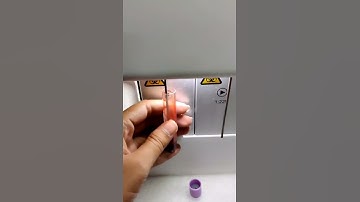 complete blood count (CBC) test #shorts | procedure | blood test | pathology laboratory | dmlt bmlt