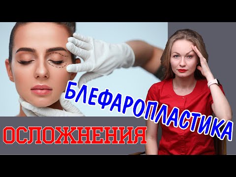 Осложнения после блефаропластики. Как их избежать? Чего надо бояться? Совет пластического хирурга.