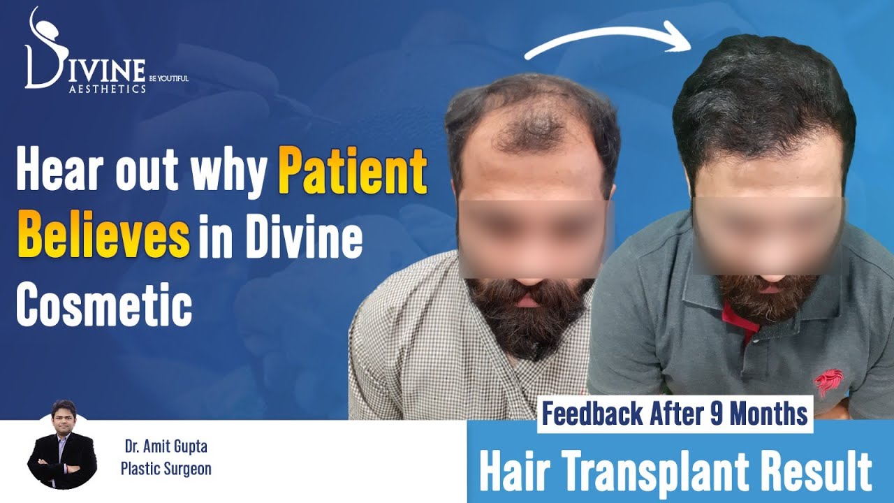 Top 165+ dr batra hair transplant cost super hot ceg.edu.vn