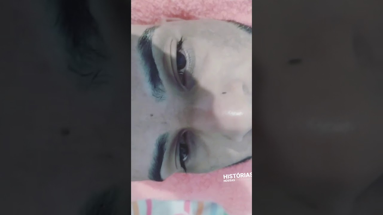 Antes e depois ( Beatriz)(1) - YouTube