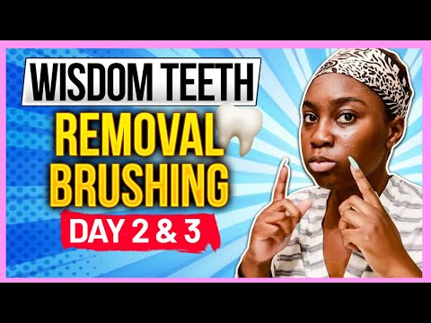 HOW To BRUSH TEETH After WISDOM TEETH REMOVAL in 2021🪥|Day 2&3 WISDOM TEETH REMOVAL Recovery Tips🦷