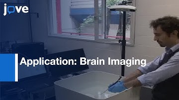 Assessing Performance Of New Ultrasound Probes Based On CMUT Technology l Protocol Preview