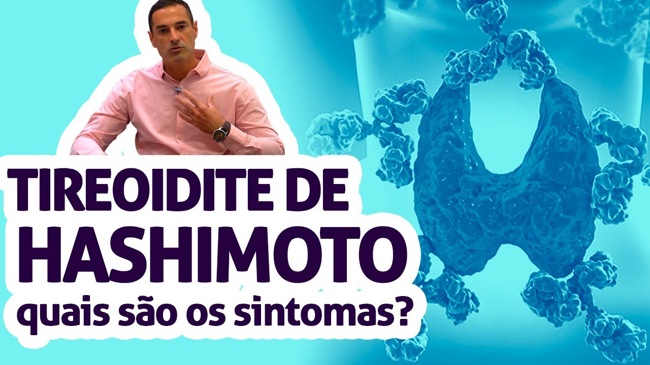 Tireoidite de Hashimoto quais são os sintomas da tireoidite de Hashimoto? YouTube