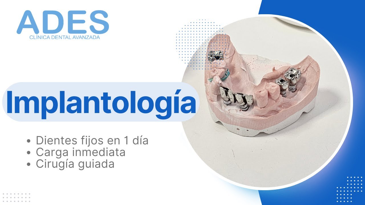 Prueba Metal. ADES Clínica Dental Avanzada en Badajoz
