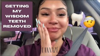 Vlog: I Got All 4 Of My Wisdom Teeth Removed Without Drugs !!! | Alizé Franco