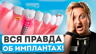 картинка: НЕ СТАВЬТЕ ИМПЛАНТЫ, пока не узнали эти 5 фактов! ПРАВДА, которую НЕ расскажут на консультации!