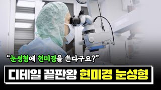 눈성형에 현미경을 쓴다?🔬│현미경 눈성형에 대한 Q&amp;A 대공개😎