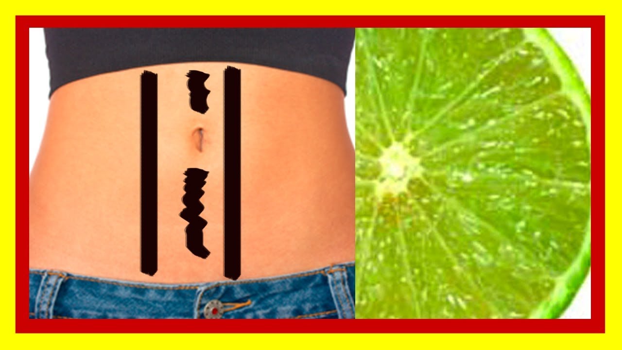 Remedios para Aclarar LOS VELLITOS DEL ABDOMEN ( Bien Explicado ) YouTube Remedios para Aclarar LOS VELLITOS DEL ABDOMEN ( Bien Explicado ) YouTube