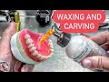 PART 2 WAXING AND CARVING AN IMMEDIATE/SURGICAL UPPER DENTURE WITH SECRET TIPS.