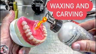 PART 2 WAXING AND CARVING AN IMMEDIATE/SURGICAL UPPER DENTURE WITH SECRET TIPS.