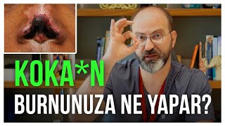Koka*N Içenlerde Burun Nasıl Zarar Görür? Çözümü...