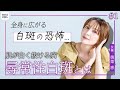 異変を放置...奥菜恵が発症した難治性の病「白斑」の原因を専門医が解説