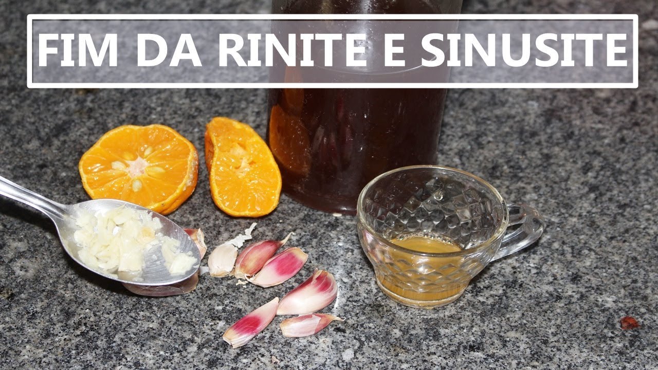 COMO ACABAR COM A SINUSITE, RINITE EM DOIS MINUTOS! TIRO E QUEDA! Fran Adorno
