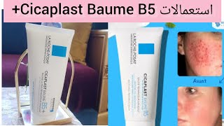 استعمالات و فوائد أقوى كريم مرطب ومعالج لجميع أنواع البشرة /تجربتي مع Cicaplast baume B5