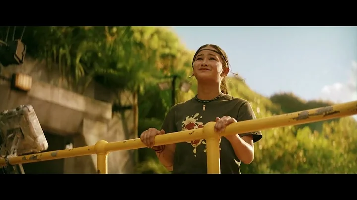 Godzilla x Kong: The New Empire -  Kong's Tooth Extraction