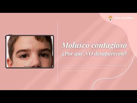 Molluscum contagiosum in children: what you need to know