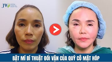 Chồng HÚ HỒN vợ MẶT HÓP bỗng TRẺ 20 tuổi, được Bác sĩ Tú Dung CẤY MỠ MẶT Cải lão gương mặt 3M