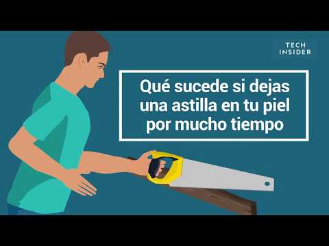 Video: ¿Cuándo desaparecen las astillas?