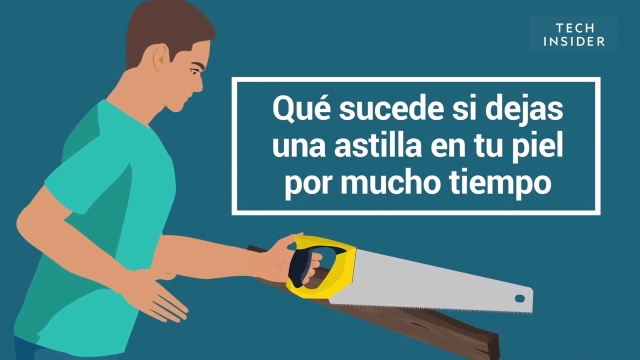 como sacar una astilla de la yema del dedo
