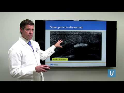 Insight into Peyronie&rsquo;s Disease: Cause and Treatment for Penis Curvature | UCLAMDChat