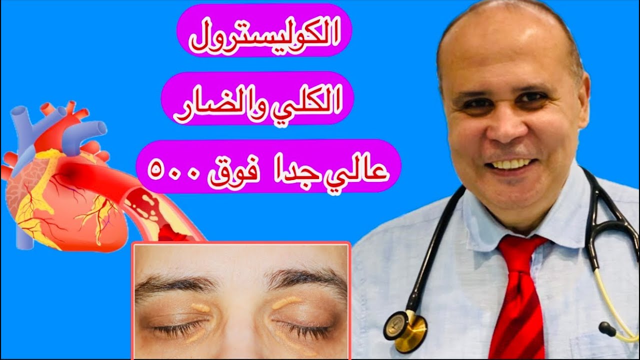 لم أكن اتوقع أن الكوليسترول الكلي  والضار والدهون الثلاثيه عالي جدا علامات ارتفاع الكوليسترول