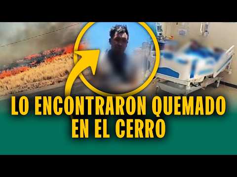Querían apagar los incendios pero terminan quemados: Hombres sufren graves quemaduras en Puno