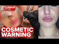 DIY cosmetic surgery trend has medical experts on edge | A Current Affair