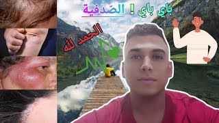 بعد سنين من المعاناة مع  الصدفية  جا الفرج ?? بمكون طبيعي واحد ? الحمد لله ?