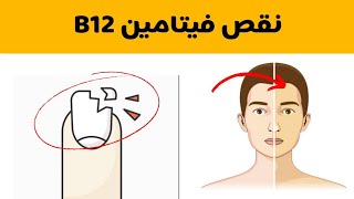 أعراض نقص فيتامين B12 وعلاماته | ما هي أهميته في جسم الإنسان؟