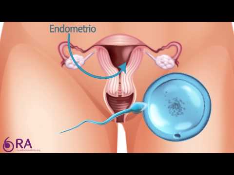 Video: ¿Dónde se encuentra el endometrio?