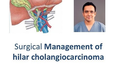 Surgical management of Hilar cholangiocarcinoma - Phani Krishna Ravula