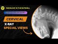 CERVICAL XRAY VIEW || CERVICAL XRAY POSITION || INDICATION , CONTRAINDICATION AND PREPRATION ||