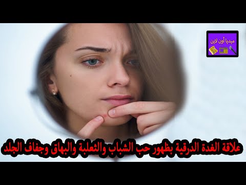 فيديو: هل يسبب قصور الغدة الدرقية ظهور حب الشباب؟