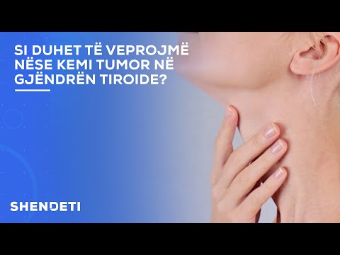 Video: A duhet hequr struma shumënodulare?