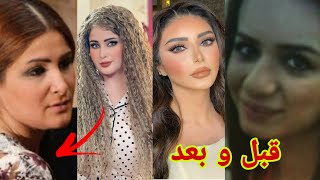 10 فنانات عراقيات 🇮🇶 قبل وبعد عمليات التجميل صدددددمه😲