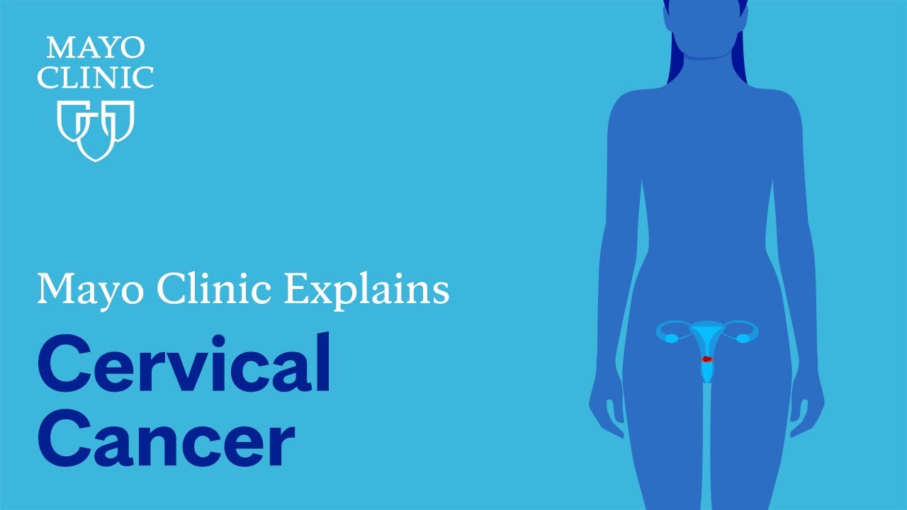 What Is Cervical Cancer? - NCI