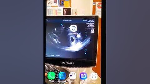 Crypto 101: Opening an Opensea Account via Trust Wallet