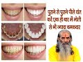           ayurvedic teeth whitening  swasth vichar