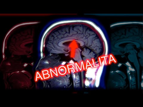 Video: Aká je definícia vedomia?