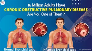 Chronic Obstructive Pulmonary Disease Overview (types, pathology, treatment)  | eGlobalDoctors