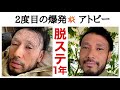 【アトピー完治へ】脱ステ丸1年経過報告と2回目の爆発期の対応